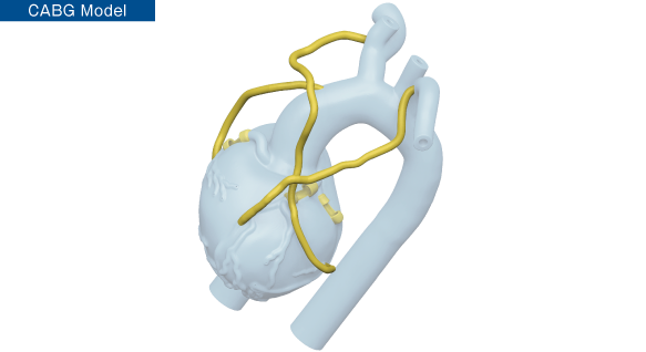 CABGモデルの特徴