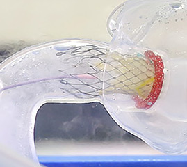 X線透視下でTAVIのトレーニングが可能です。カテーテルを通しての冠動脈造影もできるため、ステントバルブの留置位置と冠動脈の位置を確認しながら実際の手技を再現する