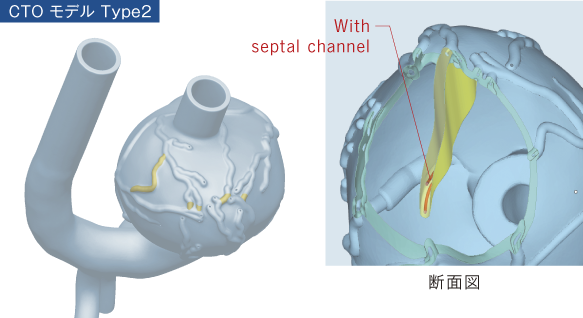 CTOモデル